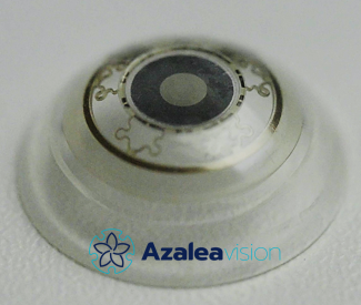 smart contact lens